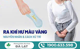 Hình ảnh minh họa